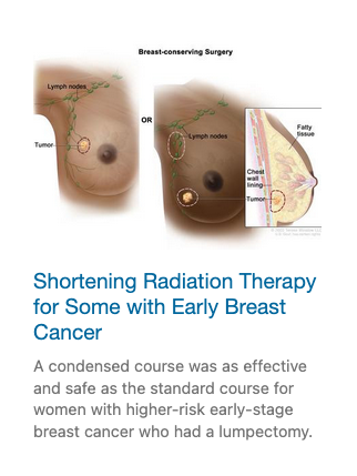 radiation therapy